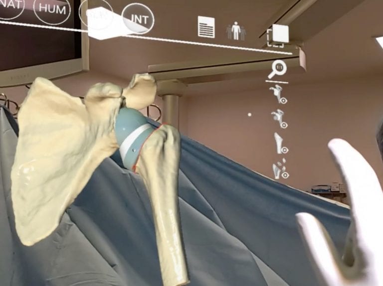 Ms Ruth Delaney talks to Newstalk on Mixed Reality Shoulder Replacement