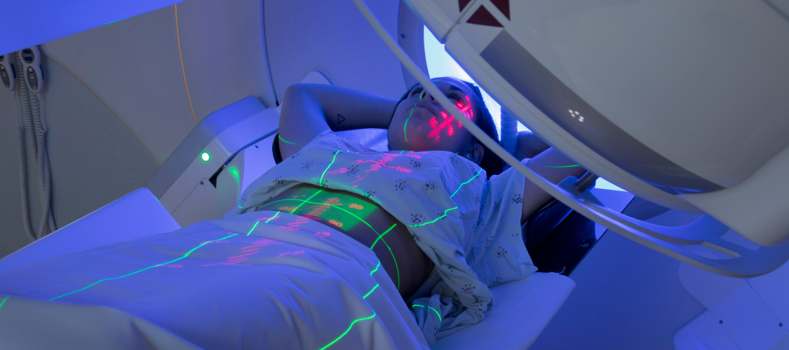 Skin Cancer Treatment Options: Radiation Therapy